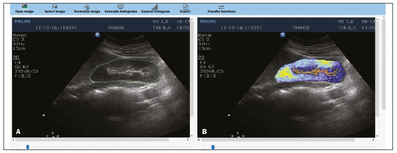 Atlas of Renal Ultrasonography 希少 腎臓 | gulatilaw.com