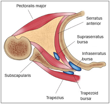 váll scapularis artrosis