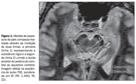 Bronstein - RM, Já imaginou um exame que pode detalhar todos os tecidos do  corpo em imagem, detectar cânceres, mapear a atividade cerebral e, ao  contrário do raio-X, não