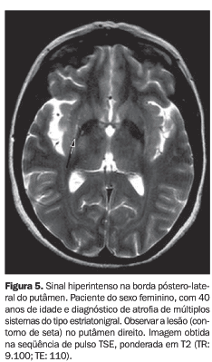 Bronstein - RM, Já imaginou um exame que pode detalhar todos os tecidos do  corpo em imagem, detectar cânceres, mapear a atividade cerebral e, ao  contrário do raio-X, não