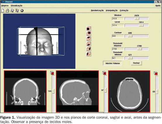 A questão baseia-se na Figura 1, que mostra um algoritmo