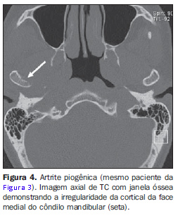 TC DE MANDIBULA • AMD Saúde