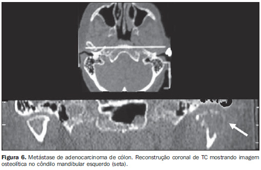 Investigarea radiologică a articulaţiei temporo-mandibulare