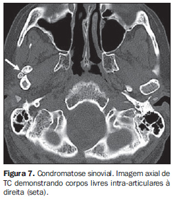 Investigarea radiologică a articulaţiei temporo-mandibulare