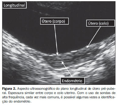 Ultrassonografia pélvica