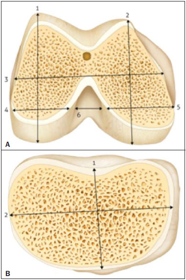 osteoartrita initiala)